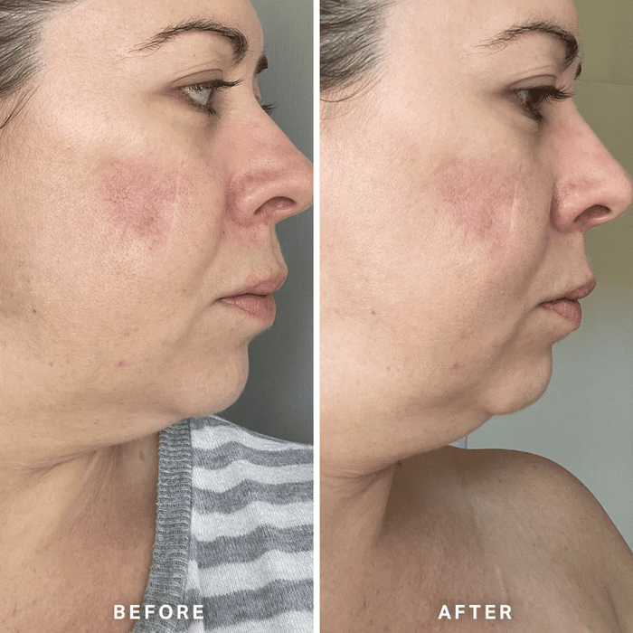 Alpha-H Vitamin A Serum 10ml