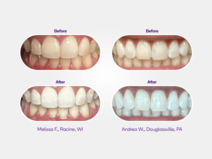 Mint Non-Slip Whitening Strips Refill