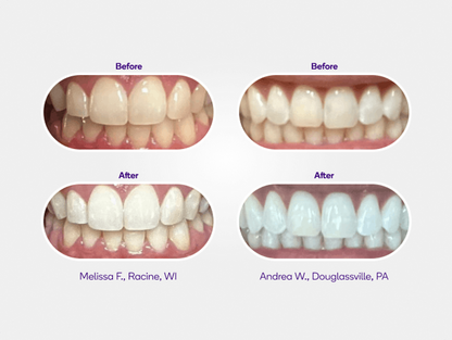 Mint Non-Slip Whitening Strips Refill
