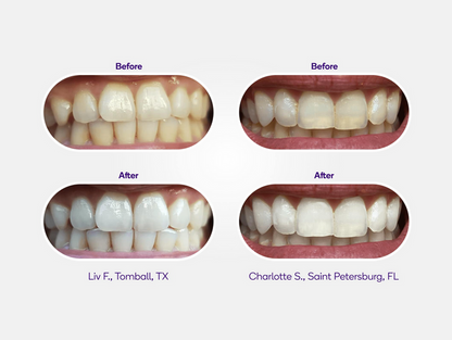 Mint Non-Slip Whitening Strips Refill