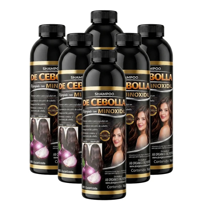 Onion Shampoo Reinforced with Minoxidil (6 Pack) – Premium Hair Growth & Anti-Hair Loss Formula
