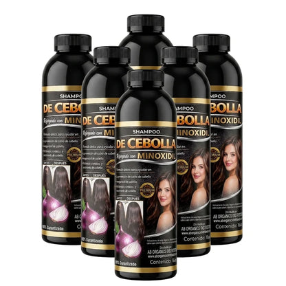 Onion Shampoo Reinforced with Minoxidil (6 Pack) – Premium Hair Growth & Anti-Hair Loss Formula